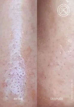 Outlet Spezialpflege·Akne