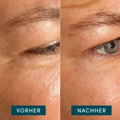 Hot Augenpflege·Augenpflege