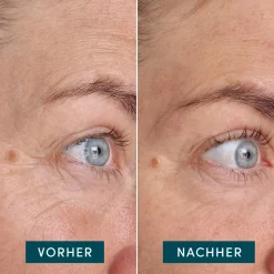 Sale Augenpflege·Augenpflege