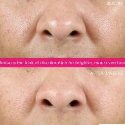 Best Reinigung·Gesichtspeeling|Gesichtpflege·Gesichtspflege