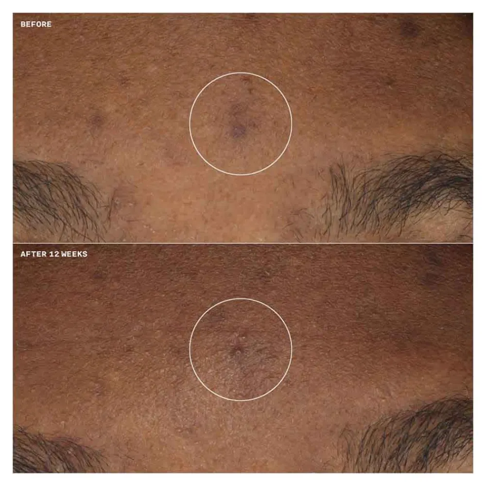 Online Gesichtpflege·Gesichtspflege