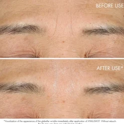 Hot Anti Aging·Anti-Aging